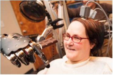 Can-Do-Ability: Paralysed woman controls robot arm with her brain